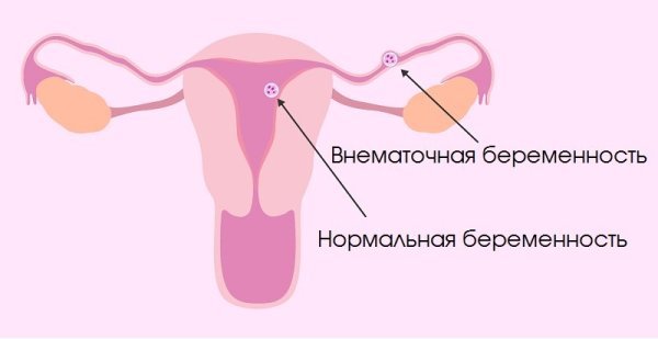 Причини і лікування болю в правому боці під ребрами