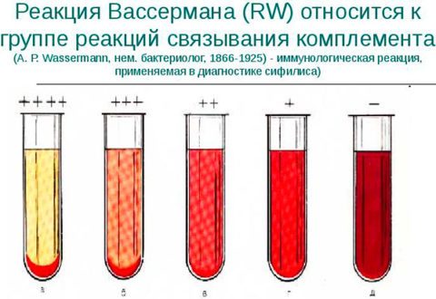 Реакція Вассермана (аналіз на сифіліс)