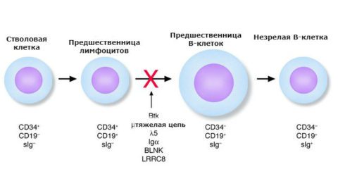 Хвороба Брутона: причини, і як її лікувати