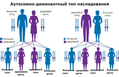 Все про спадковий елліптоцітоз